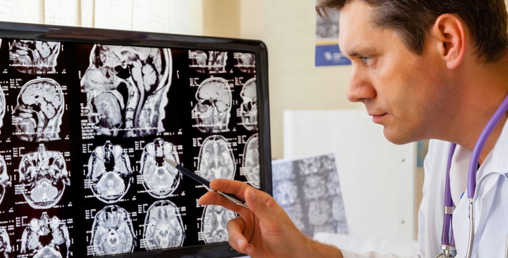 בדיקת MRI מוח וראש (נוירורדיולוגיה אבחנתית)